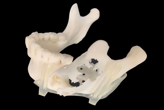 定制式3D打印醫(yī)學(xué)模型