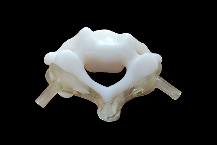 定制式3D打印醫(yī)學(xué)模型